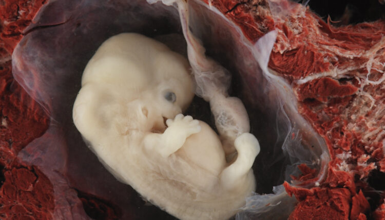 Human embryo 6 7 weeks.jpg